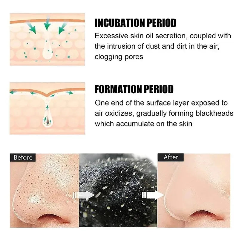 10/150PCS Blackhead Remove Mask Nasal Strips Shrink Cleansing Pore Nose Black Head Remove Stickers Skin Care Mask Patch Unisex